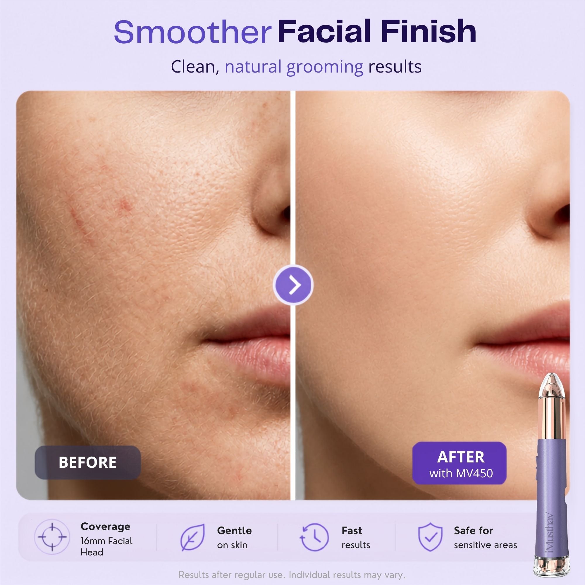 iMusthav 2-in-1 Facial & Eyebrow Hair Trimmer for Women MV450