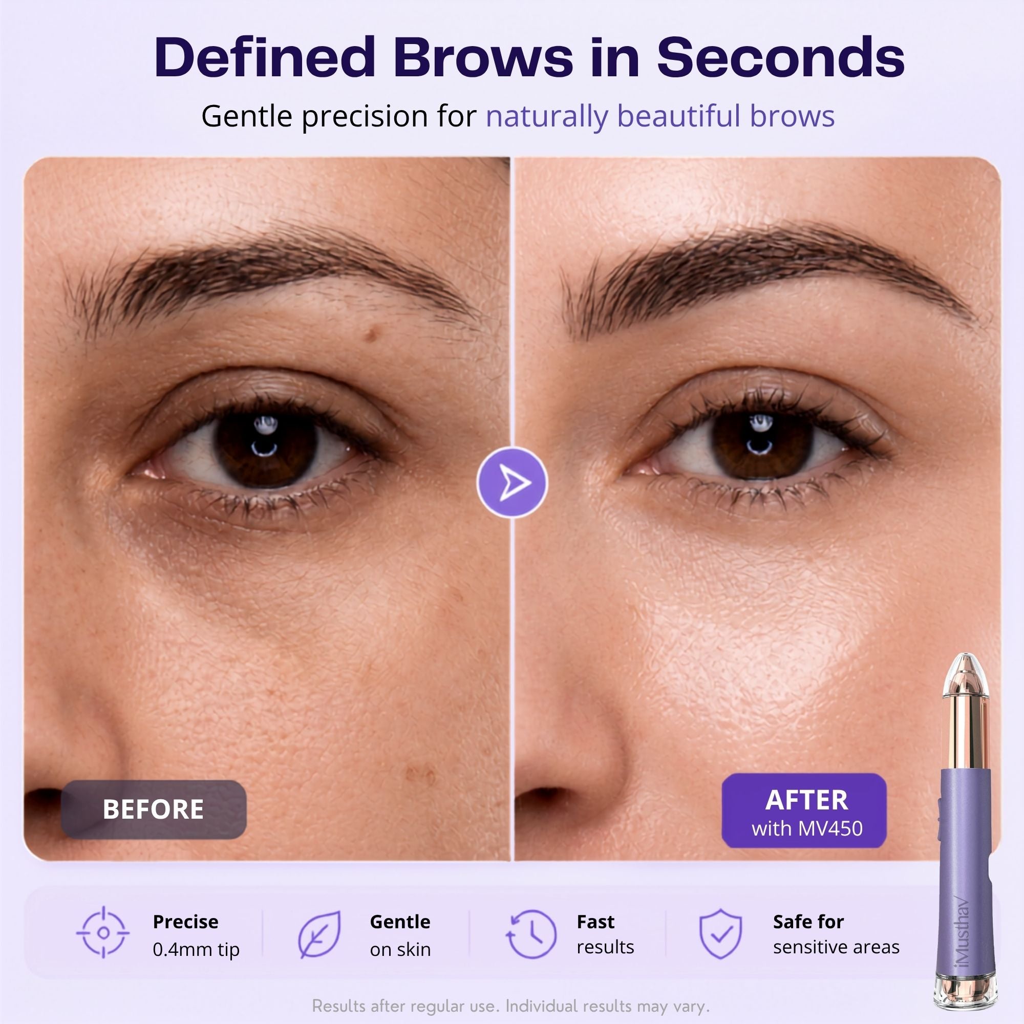 iMusthav 2-in-1 Facial & Eyebrow Hair Trimmer for Women MV450